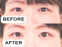 ビハリスト 恵比寿/目元のむくみが解消