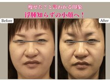 トータルセラピー リッチ(Rich)/宮崎市 エステ