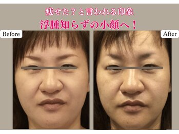 トータルセラピー リッチ(Rich)/宮崎市 エステ