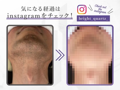 ブライトクォーツ(bright quartz)の写真