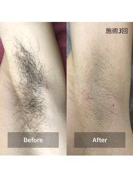 ラフルール(LA FLEUR)/