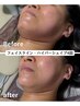 2回目以降：小顔フェイシャル60分【気になるお肉を解消】
