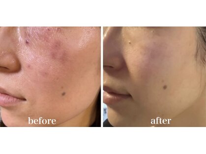 トータルエステサロン ポイント(POINT)の写真