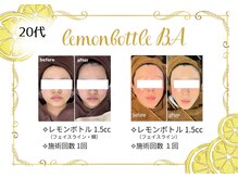 アヤエステティックサロン 綱島店(AYA)/大人気のレモンボトルで小顔