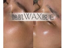 エステ リラクゼーションサロン(more)