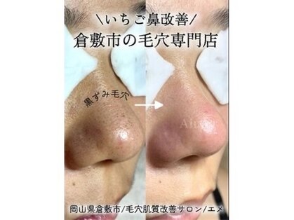 エメ(Aimer)の写真