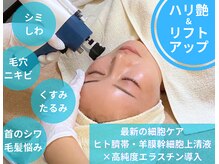 アンノン(Annon)