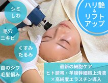 アンノン(Annon)