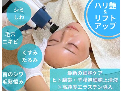 アンノン(Annon)の写真