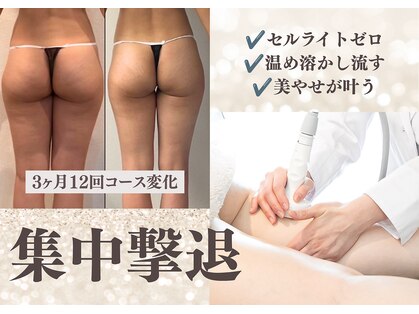 ピッコロ(piccolo)の写真