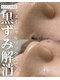 ここはなの写真/お顔の脱毛が気になる方へ♪【フェイシャル脱毛ワックス(90分)¥10,800→¥8,800】トーンアップ効果も◎