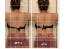 ラヴィエール(Laviere)/【セルドライブ１回!!背中・腕】