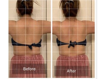 ラヴィエール(Laviere)/【セルドライブ１回!!背中・腕】