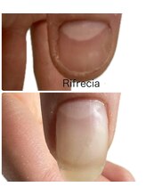 リフレシア(Rifrecia)/美爪さん誕生