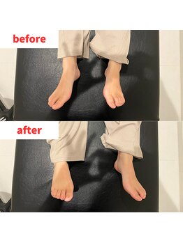 ナオル整体 福岡香椎院(NAORU整体)/20代女性施術事例【右脚開き】