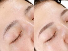 ホワイトアイ 小山(WHITE EYE)