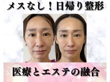 メディカルエース(MedicalAce)の雰囲気（たるみ改善から美肌まで幅広く対応。看護師目線での技術提供！）