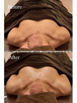 プリマベラ 大阪梅田(primabella)/巻き肩改善でハリのあるバスト