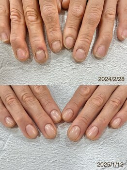 リファーレ(RIFARE)/【深爪矯正】現役大工さん