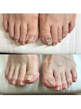 リリ(lili)/フットケア/ネイルケア