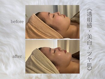 ジュプン 長崎/復元パックビフォーアフター