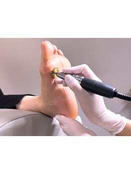 角質ケアができるサロン