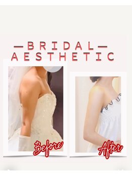 ティアエ(T-ae)/【ブライダルエステ】