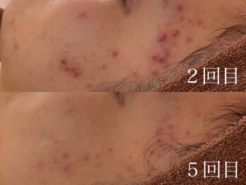 ホワイトアクア 四日市店(WHITE AQUA)/結果重視サロン四日市ハーブ