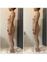 モア(moa)/たった一回でハリボリュームUP!!