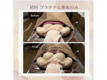 リノレア(LinoLea)/