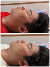 ステラ 武蔵小杉(Stella)/プラズマ B/A