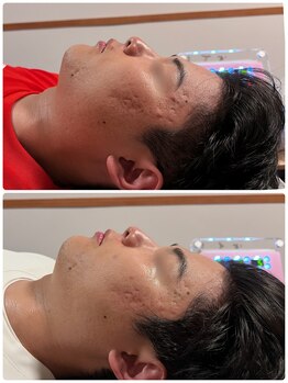 ステラ 武蔵小杉(Stella)/プラズマ B/A