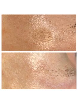 マルサンカクシカク(○△□)/