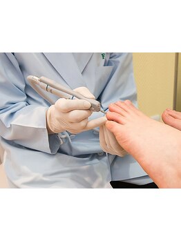 爪の悩みを解消できる（ケア含む）