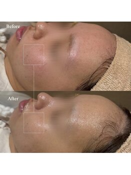 韓美(KANBI)/韓国肌管理Before After