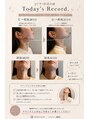 ワムサロン(WOM SALON) 施術後は可動域が広まりここまでの変化を感じていただけます。