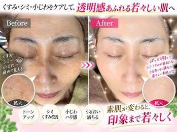 イアリイ/肌質改善スキンケアコース