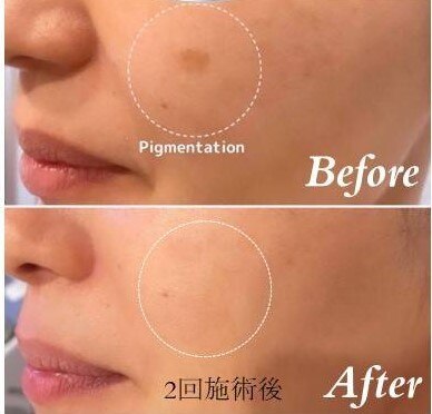 埼玉県でコラーゲンマシンが人気のエステサロン｜ホットペッパー