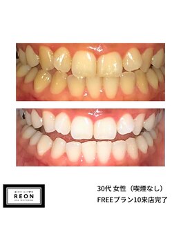 レオン 磐田(REON)/◇ お客様 before＆after ◇