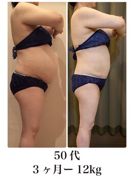 ビーシェイプ 君津(B-Shape)/【痩身】ビフォーアフター