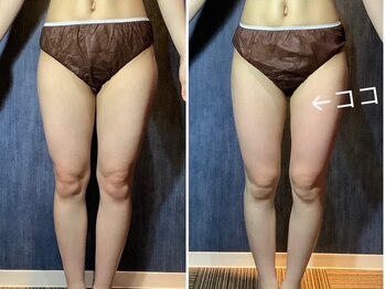 カナウ(kanau)/え、1回で!?