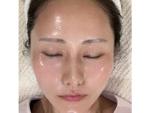 艶肌／本気の方艶肌に改善/インナーケア＆アフターフォロー