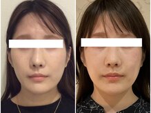 美容整体ウェリナ 名駅院/小顔矯正/骨盤矯正/美脚サロン