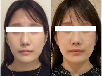 美容整体ウェリナ 名駅院/小顔矯正/骨盤矯正/美脚サロン