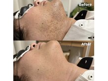 ラティア(Ratia)/