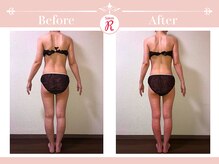 サロン アール(Salon R)/痩身施術×食事・インナーケア