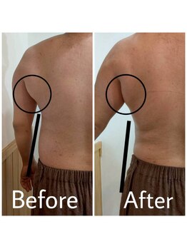 エミナル(EMINAL)/60分のウィンバック効果 後ろ