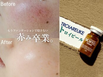 水玉サロン(水玉Salon)の写真/透明感あふれる“水光肌”へ。あなたの肌に合ったピーリングが見つかるサロン。