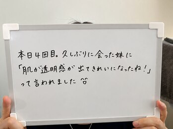 たるみアガル(たるみagaru)/板橋区　たるみ/フェイシャル