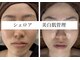 シェロア【美白フェイシャル/毛穴/小顔/マッサージ/肌管理】の写真